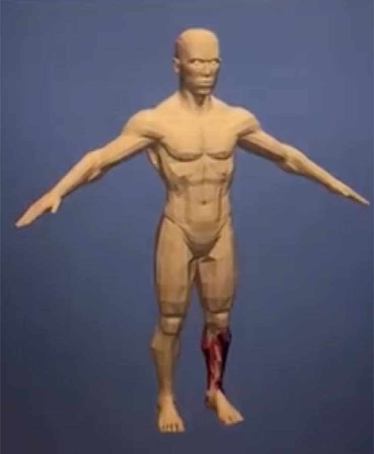 A simulation modeling tumor growth